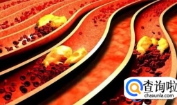 血液“稀释剂”公布，不是柠檬水，医生：坚持喝帮助血管边通畅