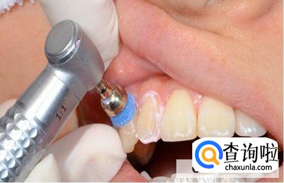 洗牙后使用电动牙刷好吗