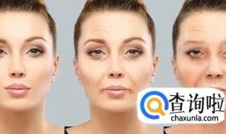 脸上皱纹多是什么原因形成的？