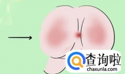 儿童肛门瘙痒是怎么回事