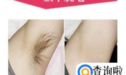 怎样去除腋下毛发