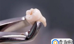 智齿烂了一个洞很痛怎么办