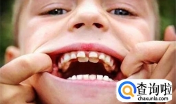 儿童乳牙没掉长出恒牙怎么办？如何预防双排牙？