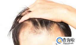 14岁发际线怎么养回来