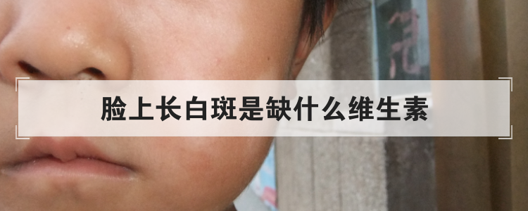 脸上长白斑是缺什么维生素