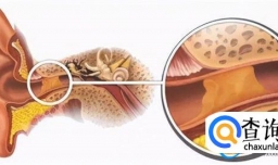耳屎是怎么保护耳朵的