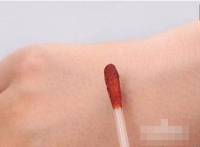 被虫子咬了怎么办