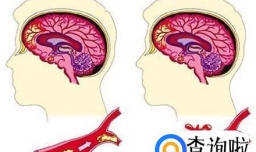α-亚麻酸对人体的8大作用