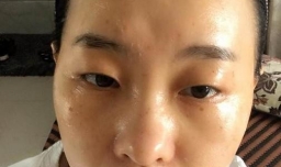 引起皮肤暗黄的原因有哪些？