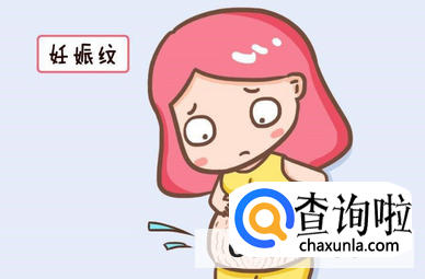 孕妇妊娠纹怎么预防