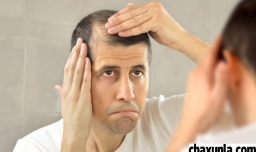 脱发怎么能缓解