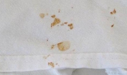 衣服上的血渍用什么水洗容易洗掉？