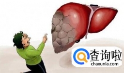 肝炎的早期症状及注意事项