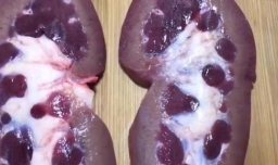 爆炒腰花的做法和技巧