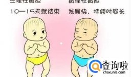 婴儿黄疸应该怎样处理