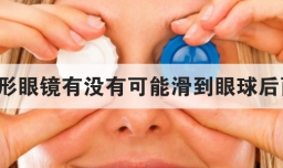 隐形眼镜有没有可能滑到眼球后面