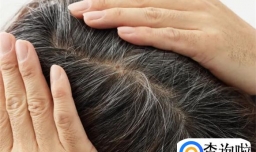 想的东西多了会导致白头发吗