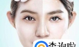 皮肤变黑以后我们又应该如何解决？