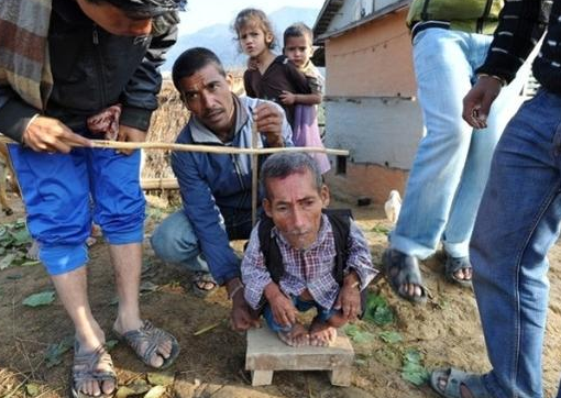 世界上最矮的人