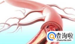 淋巴排毒有什么好的效果