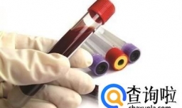 身体上出现4个信号，就说明你的血液黏稠！