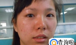 长期使用粉底液对皮肤有什么危害