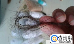 女孩为什么掉头发很厉害