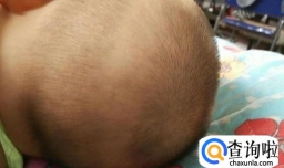 宝宝为什么会枕秃？如何预防宝宝枕秃？