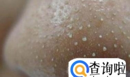 你知道鼻翼两侧的白色颗粒是什么吗？