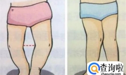 缺乏维生素D对宝宝的发育和健康会产生不可忽视的影响