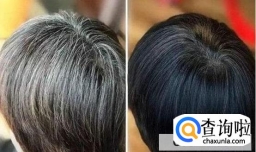 产生白发的原因