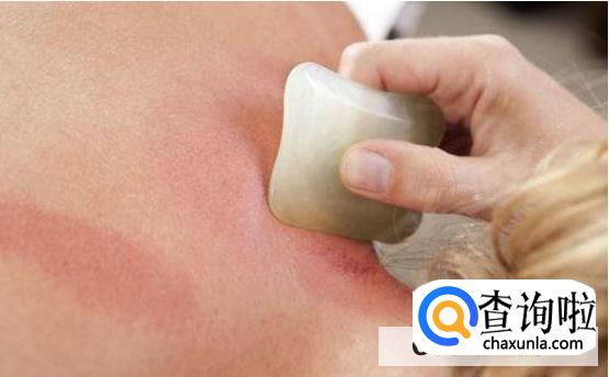 刮痧时的注意要点