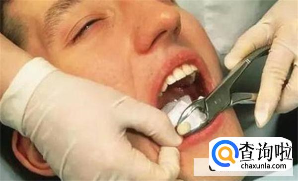拨牙几小时可以吃饭