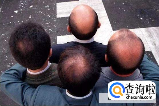 引起脱发的原因