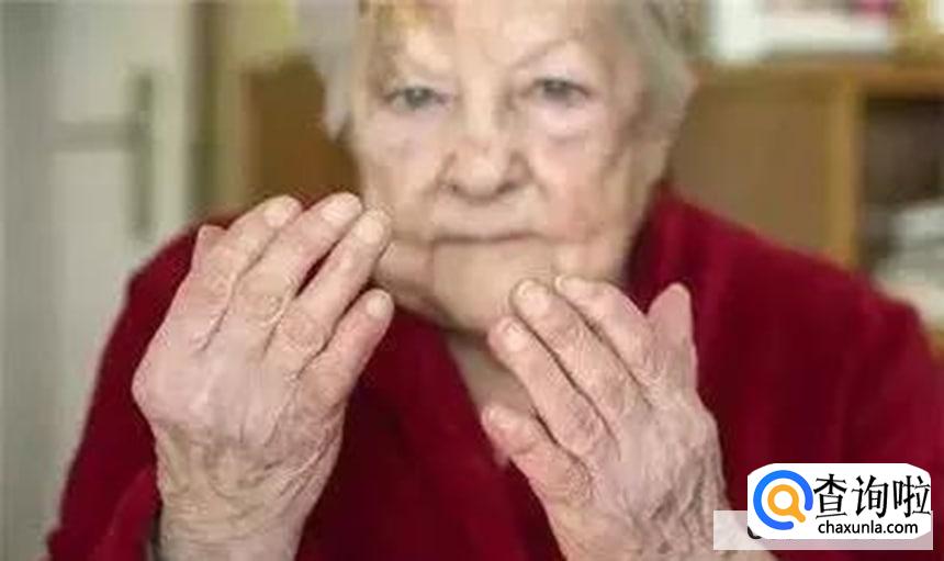 如何预防风湿病