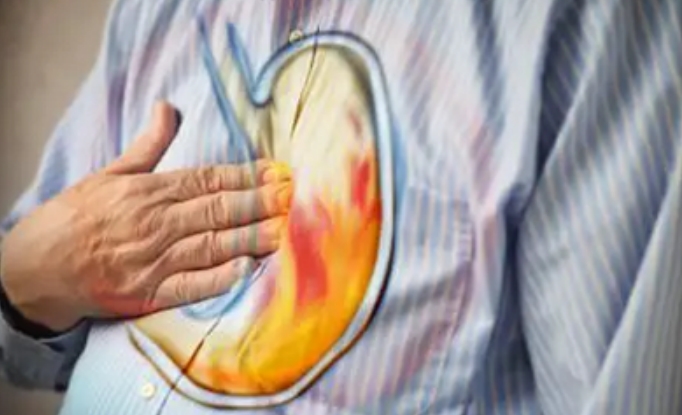 如何预防胃食管反流