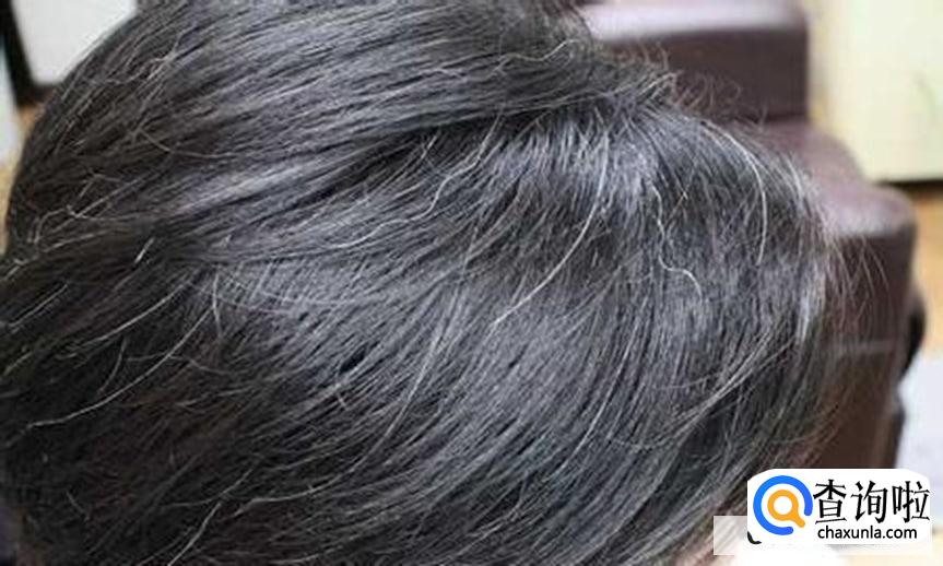 该如何预防少白头