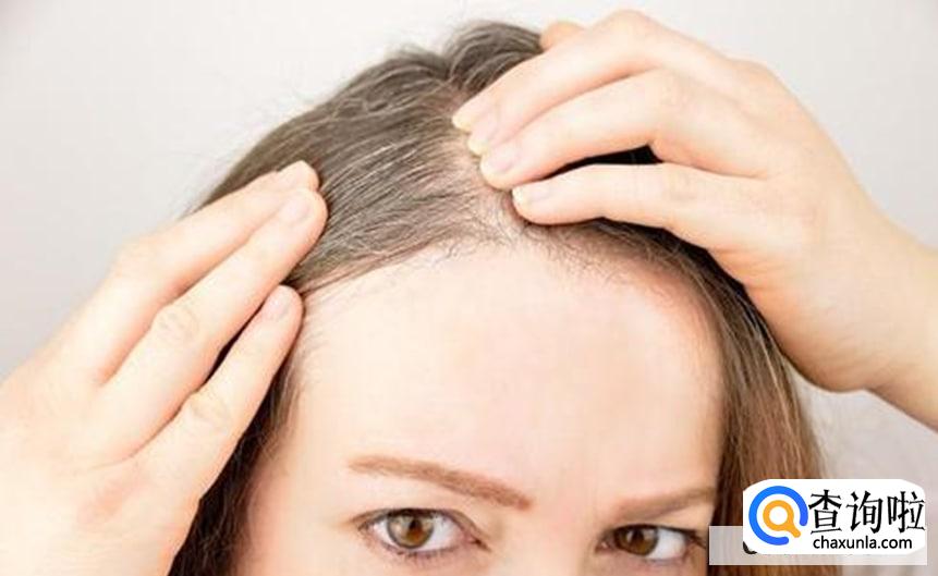 该如何预防少白头