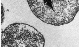 什么叫“热原”？“热原”的性质有哪些？