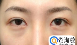 为什么脸上的皮肤会衰老的特别快