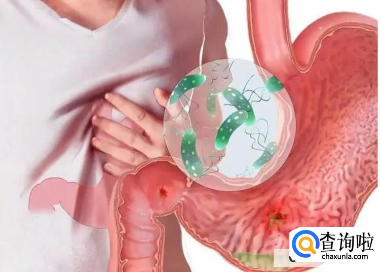 慢性胃炎如何根治？