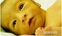 新生儿黄疸怎么退黄快？