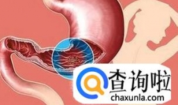 酒后黑便是什么原因