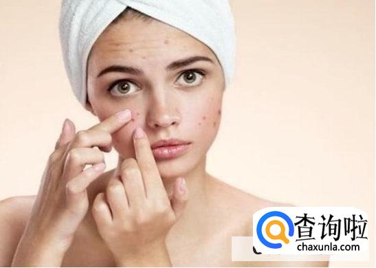 肝硬化脸上长痘的原因