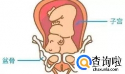 讲解胎儿不入盆的原因