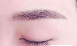 都有哪些人需要做提眉术？