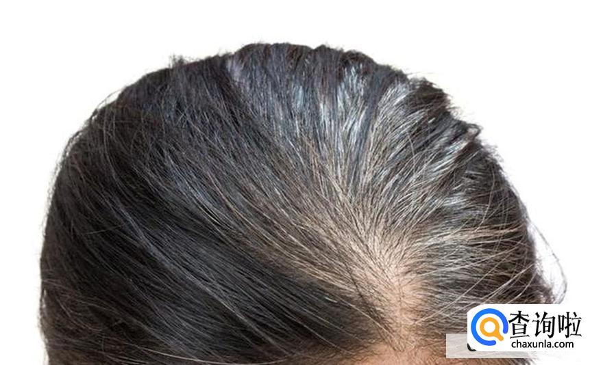 该如何预防少白头