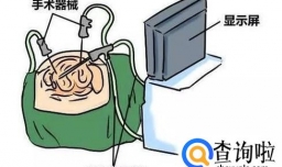 先天性无子宫有什么表现