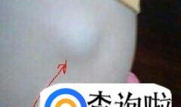 宝宝长淋巴结怎么办