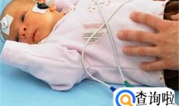 如何测试新生儿听力
